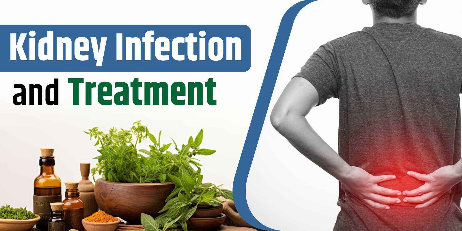 Kidney Infection and Treatment | Effective Solutions