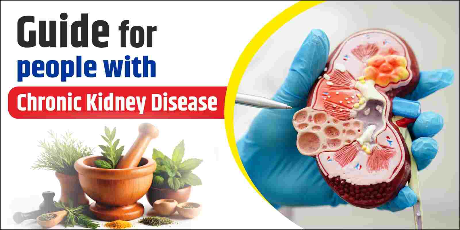 guide for people with chronic kidney disease